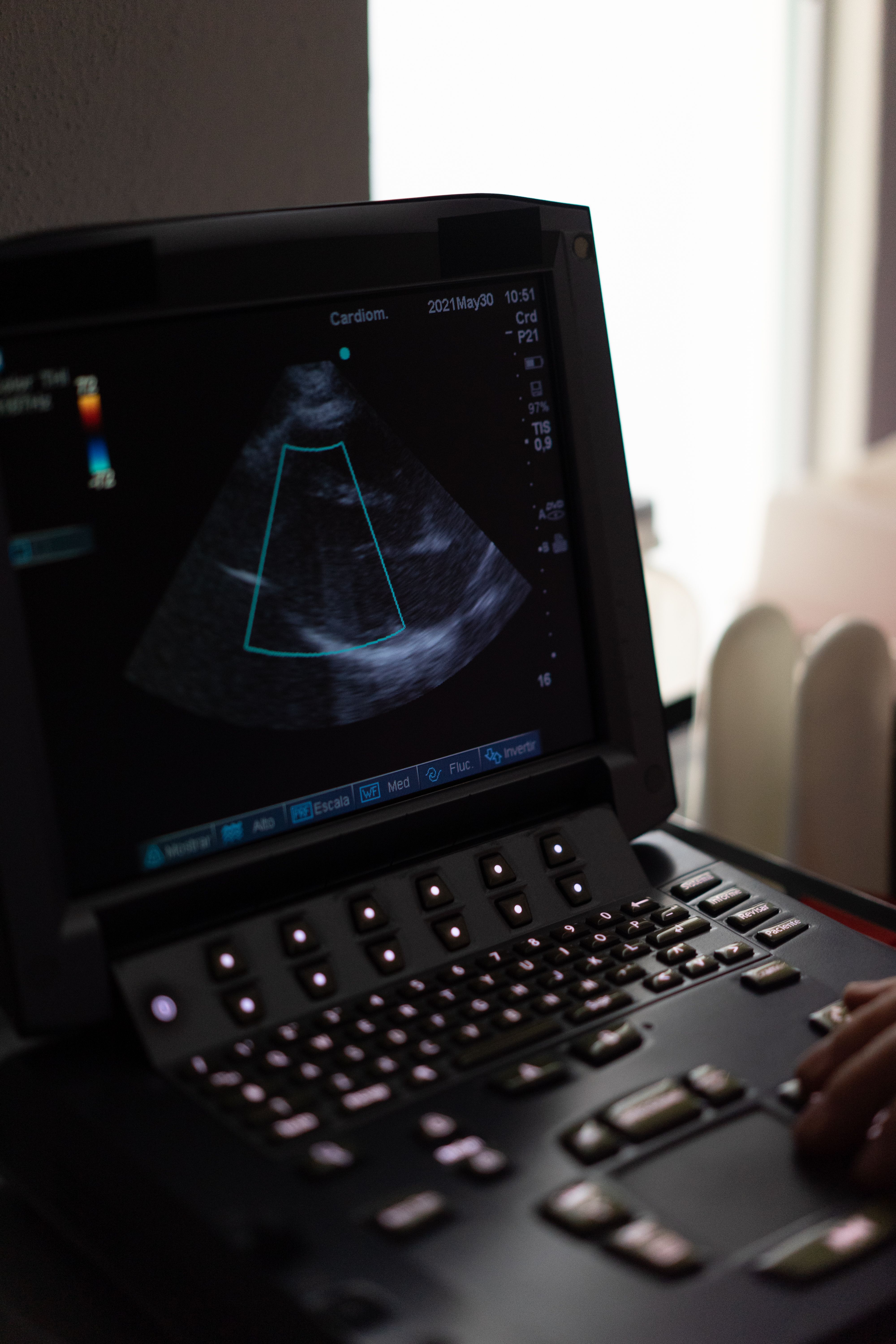 Tilburg cardiology team introduces minimally invasive valve repair program